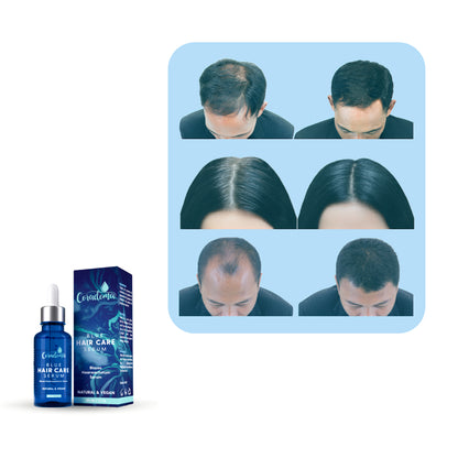 Coradoma® Blaues Haarserum Anti Haarausfall Serum für Frauen und Männer